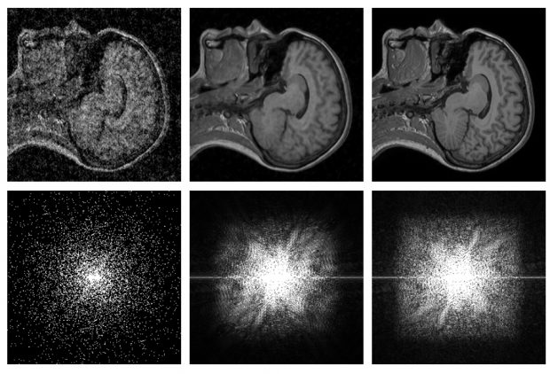 Noise2Noise AI, Bozuk Resimleri Mükemmelleştiren Yapay Zeka Teknolojisi